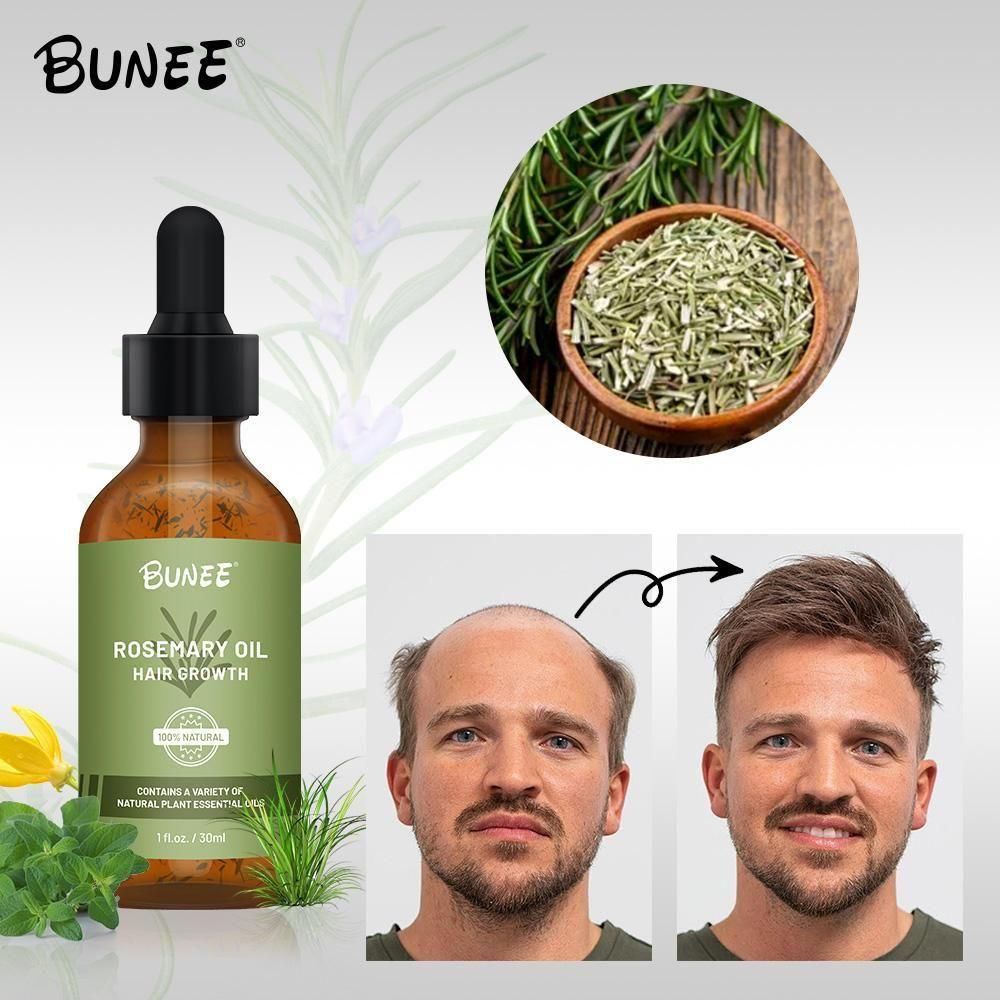 BUNEE™ Ayurvedic Rosemary Hair Oil – Fight Hair Loss, Boost Growth in 21 Days (30 ML)