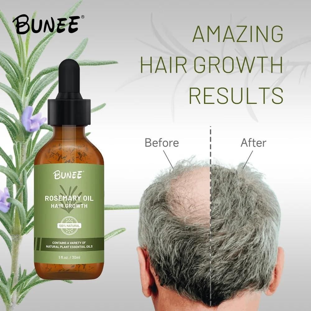 BUNEE™ Ayurvedic Rosemary Hair Oil – Fight Hair Loss, Boost Growth in 21 Days (30 ML)